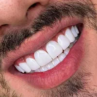 کامپوزیت دندان