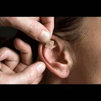 حجامت بادکش امبدینگ طب سوزنی فصد خون زگیل تناسلی|خدمات آرایشگری و زیبایی|اصفهان, سعادت‌آباد|دیوار