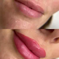 ۴۰٪تخفیف پاک‌کردن تاتو صورت میکرو ابرو تا آخر هفته|خدمات آرایشگری و زیبایی|دزفول, |دیوار