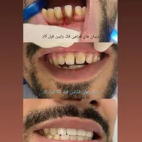 کلینیک تخصصی دندانپزشکی امین|خدمات آرایشگری و زیبایی|مشهد, چهارچشمه|دیوار