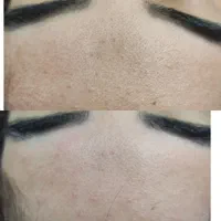 فیشال و پاکسازی پوست|خدمات آرایشگری و زیبایی|شیراز, عادل آباد|دیوار