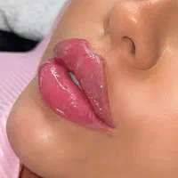جشنواره تزریق ژللب متدm بوتاکس390لیزر آنزیم هایفو|خدمات آرایشگری و زیبایی|تهران, صادقیه|دیوار