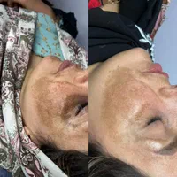 درمانگاه تخصصی ستایش پوست و زیبایی|خدمات آرایشگری و زیبایی|اهواز, کیانپارس |دیوار