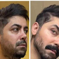 کلینیک ژل.فیلر.زاویه سازی.مادلینگ.فول فیس اقایان|خدمات آرایشگری و زیبایی|مشهد, سناباد|دیوار