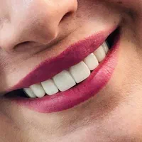 دندانسازی|خدمات آرایشگری و زیبایی|شیراز, زند|دیوار