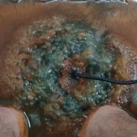 سمزدایی بدن|خدمات آرایشگری و زیبایی|قرچک, مهدیه|دیوار