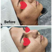 تخفیفات ویژه/اگزوزوم/مزو ژل/لیفتینگ/فشیال تخصصی|خدمات آرایشگری و زیبایی|شیراز, وحدت|دیوار