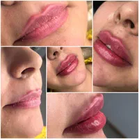 تزریق ژل و بوتاکس،ارایش دائم صورت(تاتو کل صورت)|خدمات آرایشگری و زیبایی|آزادشهر, |دیوار