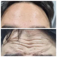 دندانپزشکی دیجیتال و طراحی لبخند اقساط|خدمات آرایشگری و زیبایی|رشت, دروازه لاکان|دیوار