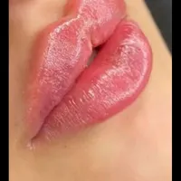 بوتاکس،تزریق ژل،مزوزیرچشم وصورت ،پرسینگ محمدشهر|خدمات آرایشگری و زیبایی|محمدشهر, |دیوار