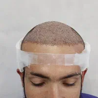 کاشت مو،کاشت ابرو و ریش تخصصی|خدمات آرایشگری و زیبایی|شیراز, قصرالدشت|دیوار