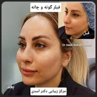 مرکز زیبایی دکتر اسدی (بوتاکس فیلر هایفو مزوتراپی)|خدمات آرایشگری و زیبایی|تهران, نیاوران|دیوار