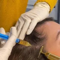 پی آر پی|خدمات آرایشگری و زیبایی|رشت, کاکتوس|دیوار