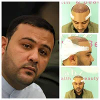 درمانگاه تخصصی پوست ، مو زیبائی لیز وکاشت مو سبز|خدمات آرایشگری و زیبایی|اهواز, زیتون کارمندی|دیوار