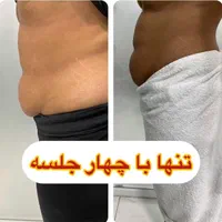 لاغری شکم پهلو پاک کردن ابرو فیشیال کوچک کردن بینی