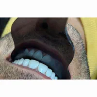 دنتال لند|خدمات آرایشگری و زیبایی|کرمانشاه, |دیوار