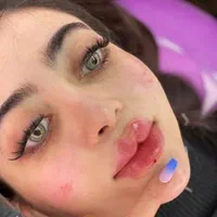 جشنواره ژل لب روسی زاویه سازی فیلر لب بوتاکس و...|خدمات آرایشگری و زیبایی|شهریار, |دیوار