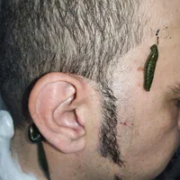 حجامت بختیاری ها،طب سنتی سوزنی ،فصد،زالو prp|خدمات آرایشگری و زیبایی|اصفهان, باغ دریاچه|دیوار