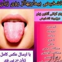 سم زدایی فیزیوتراپی حجامت و درمان کبد چرب وسیاتیک|خدمات آرایشگری و زیبایی|تبریز, |دیوار
