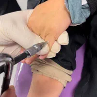 درمان زگیل تناسلی/لیزر/کرایو فریز/hpv/توسط پزشک|خدمات آرایشگری و زیبایی|اهواز, کیانپارس |دیوار