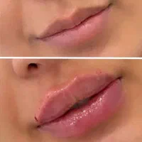 زیبایی کل صورت با سی سی 400|خدمات آرایشگری و زیبایی|اصفهان, شهشهان|دیوار