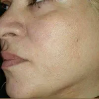 کرم کره|آرایشی، بهداشتی، درمانی|مشهد, هنرور|دیوار