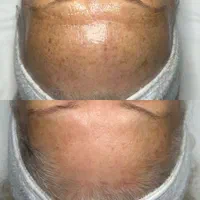 فیشال و پاکسازی پوست|خدمات آرایشگری و زیبایی|اصفهان, خواجو|دیوار