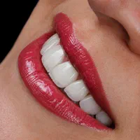 کلینیک دندانپزشکی ایمپلنت ارتودنسی زیبایی درمانی|خدمات آرایشگری و زیبایی|تبریز, |دیوار