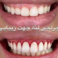 کلینیک زیبایی دندان « کامپوزیت و لمینیت اقساطی|خدمات آرایشگری و زیبایی|قم, باجک دو|دیوار