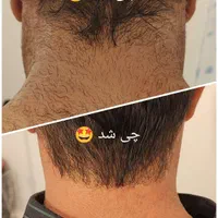 الکترولیز موهای سفیدمشکی خانم وآقا(متفاوت با لیزر)|خدمات آرایشگری و زیبایی|بندر ماهشهر, |دیوار