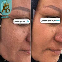 اولین مرکز روشن کننده بیکینی و زیربغل،مایابیوتی|خدمات آرایشگری و زیبایی|یاسوج, |دیوار