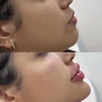 آموزش و انجام خدمات پوست و مو ژل و بوتاکس و..|خدمات آرایشگری و زیبایی|نور, |دیوار
