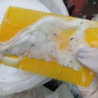 رفع تضمینی شپش و رشک بدون بازگشت بدون دوره درمان