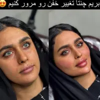 خدمات تخصصی ژل و بوتاکس|خدمات آرایشگری و زیبایی|شاهین‌شهر, فردوسی|دیوار