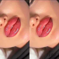 فیلر لب چانه گونه زاویه بوتاکس هایفو ژل مزو لیزر|خدمات آرایشگری و زیبایی|مشهد, فرهنگ|دیوار