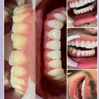 ارتودنسی توسط متخصص،دندانپزشکی اطفال،متخصص زیبایی|خدمات آرایشگری و زیبایی|اصفهان, هفتون|دیوار