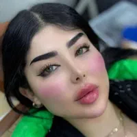 جشنواره بهاره ژل و بوتاکس آنزیم لیزر مزوتوسط پزشک|خدمات آرایشگری و زیبایی|کرج, جهان‌شهر|دیوار