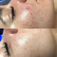 خدمات فیشال و اموزش تخصصی فیشیال|خدمات آرایشگری و زیبایی|شیراز, فرهنگ شهر|دیوار