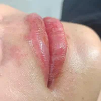 فیشیال vip با تخفیف ویژه|خدمات آرایشگری و زیبایی|مشهد, سناباد|دیوار