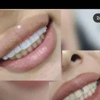 دندانپزشکی مهر با تخفیف‌های ویژه|خدمات آرایشگری و زیبایی|تهران, جنت‌آباد جنوبی|دیوار