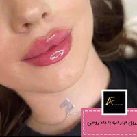 جشنواره فیلر ژل بوتاکس prpمزوتراپی لیزر توسط پزشک|خدمات آرایشگری و زیبایی|کرمان, |دیوار