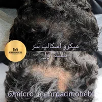 میکروبلیدینگ آقایان شیدینگ لب آقایان اسکالپ سر|خدمات آرایشگری و زیبایی|اصفهان, مرداویج|دیوار
