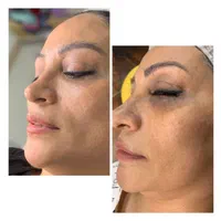 فیشیال و آبرسانی تخصصی/ خدمات و آموزش|خدمات آرایشگری و زیبایی|کرج, فاز ۲ مهرشهر|دیوار