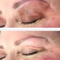پلاسما جت. لیفت ولمینت ابرو و مژه|خدمات آرایشگری و زیبایی|اصفهان, خواجو|دیوار