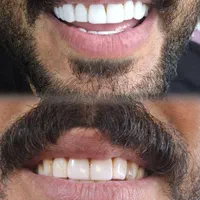 چهره زیبا