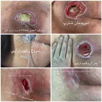 تزریقات درمنزل سرم کارشناس زخم.اصفهان و اطراف|خدمات آرایشگری و زیبایی|اصفهان, پارک مشتاق|دیوار