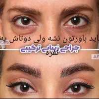 بلفاروپلاستی پلک وسانترال ودایرکت ابرو درجشنواره|خدمات آرایشگری و زیبایی|تهران, ونک|دیوار