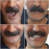 تعمیر و ساخت دندان‌های مصنوعی متحرک|خدمات آرایشگری و زیبایی|سمنان, |دیوار