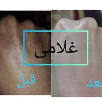 کرم معجزه ونوس لایف غلامی|آرایشی، بهداشتی، درمانی|شیراز, شیخ علی چوپان|دیوار