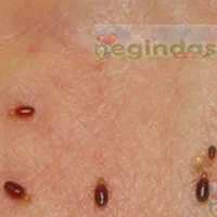 سم پاشی کامل کشنده سوسک آمریکای ساس وکنه|خدمات نظافت|آبادان, |دیوار